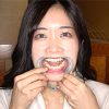 【口内】「国民的女優激似美女ことねチャンの初めての口内・のどちんこ観察！」ことね（5）